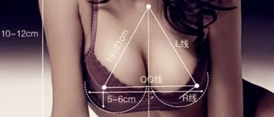 自体脂肪丰胸