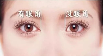 开眼角