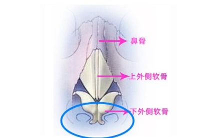 隆鼻后能不能揉呢-艺星隆鼻为您介绍