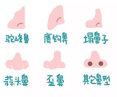 关于隆鼻的那些事儿-艺星专业讲解