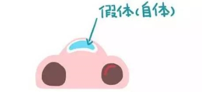关于隆鼻的那些事儿-艺星专业讲解