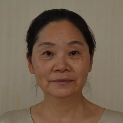 艺星去除黄褐斑前后对比图