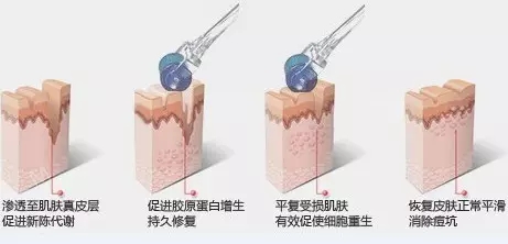 微美塑