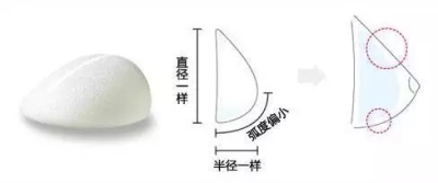 水滴形隆胸假体