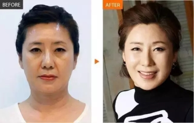 艺星真人案例