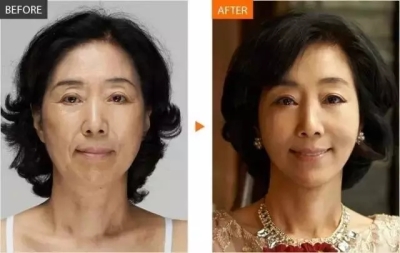 艺星真人案例